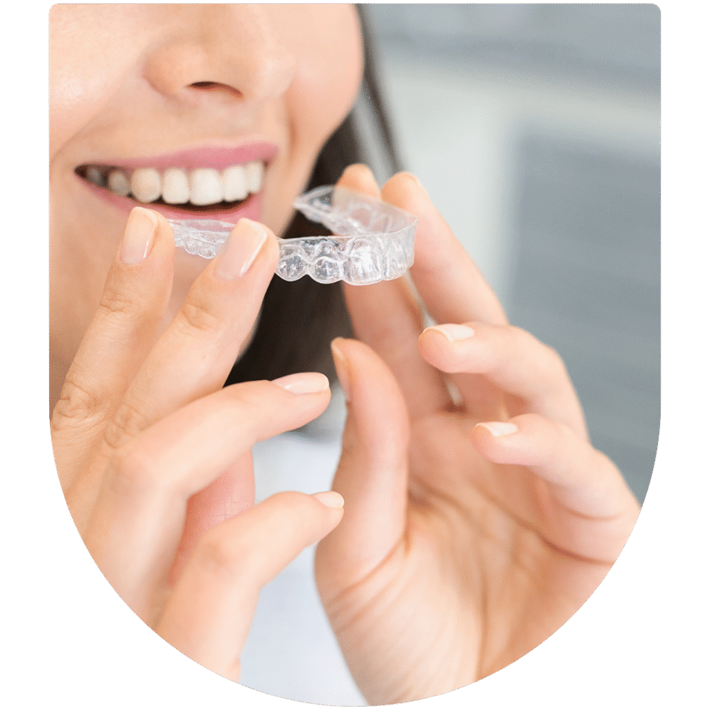 invisalign close up
